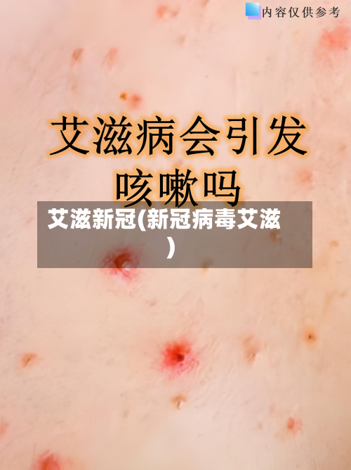 艾滋新冠(新冠病毒艾滋)-第3张图片
