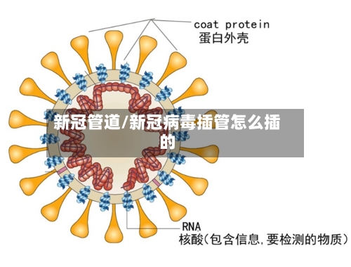 新冠管道/新冠病毒插管怎么插的