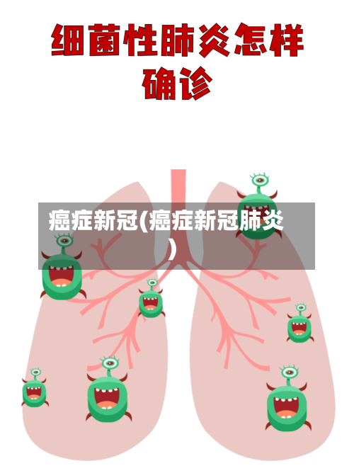 癌症新冠(癌症新冠肺炎)-第2张图片