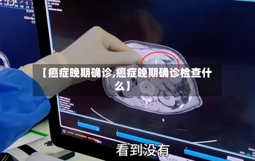 【癌症晚期确诊,癌症晚期确诊检查什么】-第3张图片