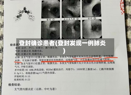 登封确诊患者(登封发现一例肺炎)-第3张图片